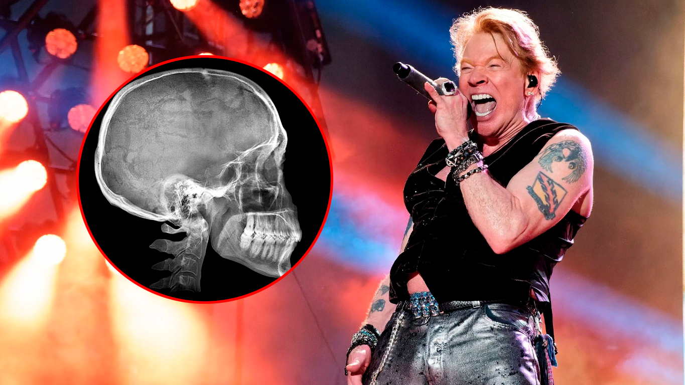 Axl Rose cantando en vivo en el MetLife Stadium durante la gira 2026